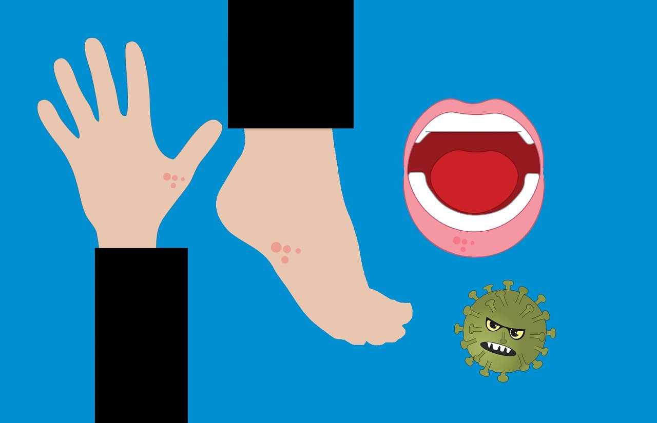 Boala Gură-Mână-Picior (Hand-Foot-Mouth disease)