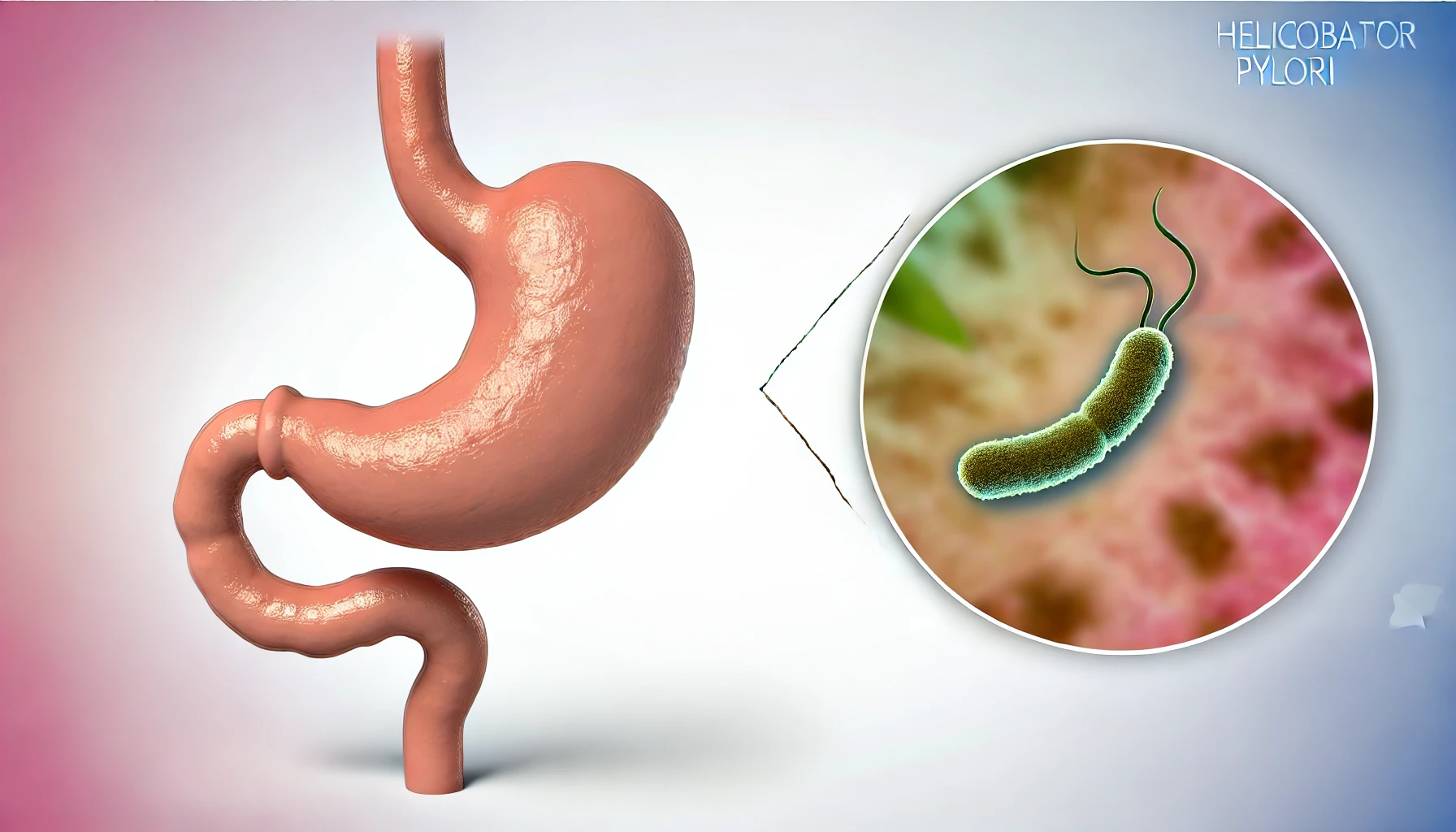 Infecția cu Helicobacter pylori la copii